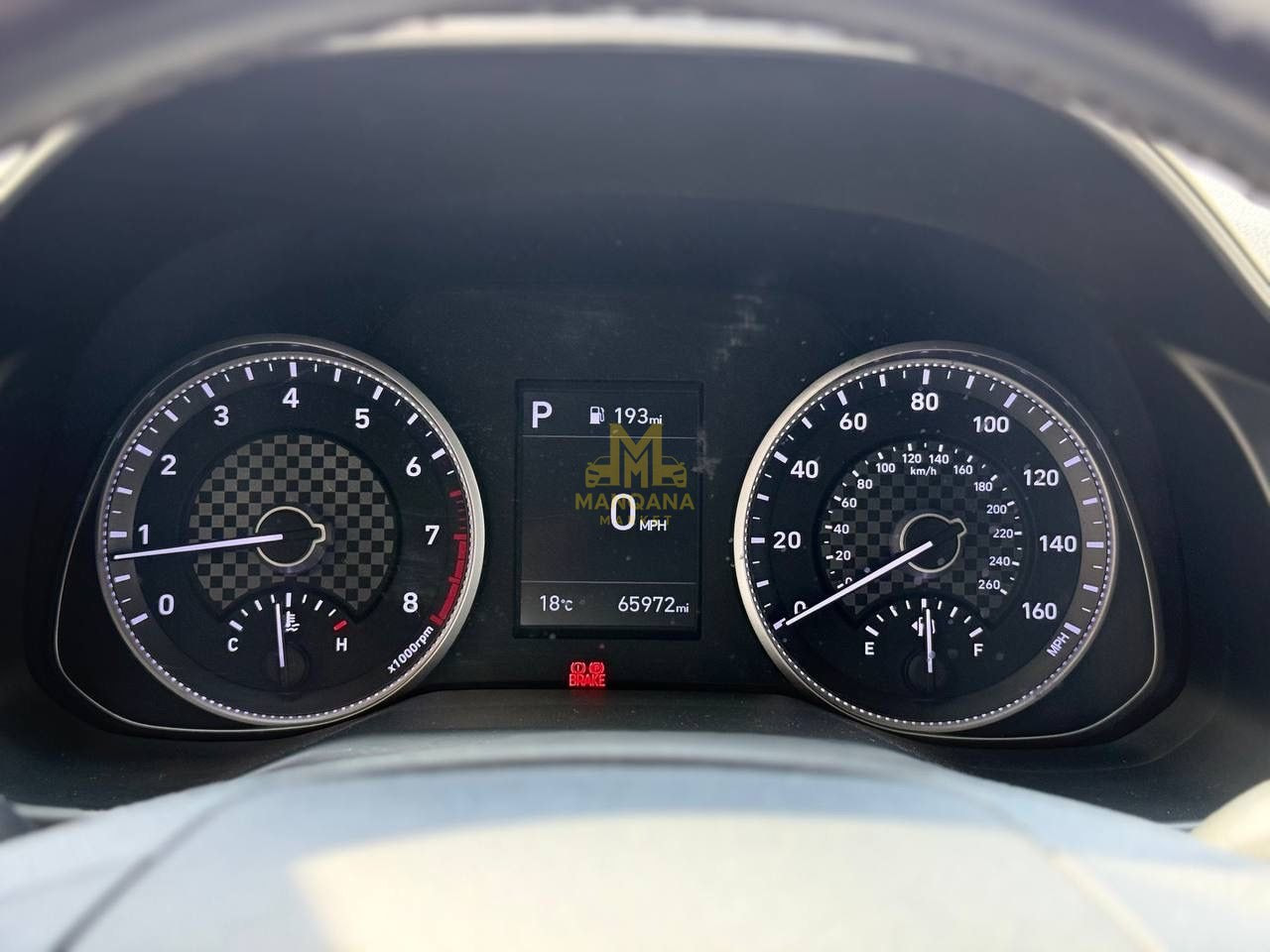 2020 HYUNDAI Elantra - Photo 3